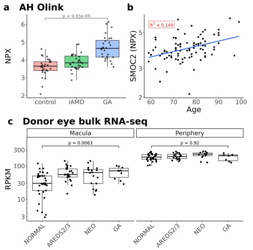 AMD biomarkers: GA controls, SMOC2 aging, macular RNA-seq.