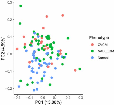 PCA scatter plot: CVCM (red), NAD_EDM (green), Normal (blue).