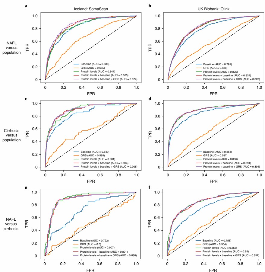 ROC curves evaluating diagnostic models for NAFL and cirrhosis.