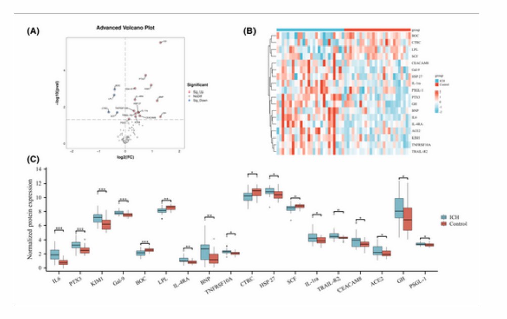 Heatmap showing inflammation-related biomarker expression differences in intracerebral hemorrhage vs normal groups.