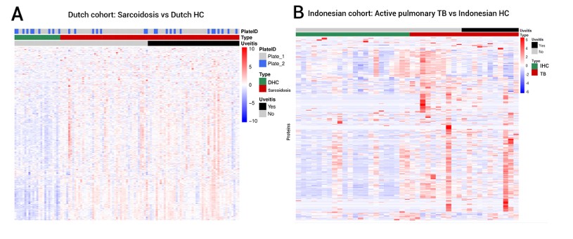 Heatmap of differentially expressed serum proteins comparing sarcoidosis versus tuberculosis cases